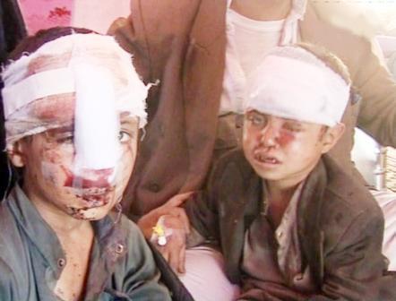 من اثار اعتداءات الحوثيين على مخيمات النازحين (مخيم سام)